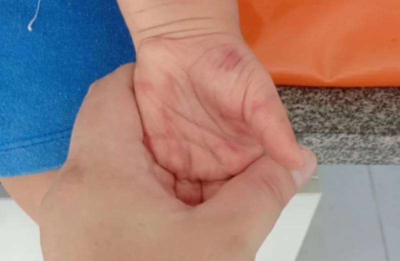 Professoras são afastadas por suspeita de maus-tratos contra criança em creche no RS