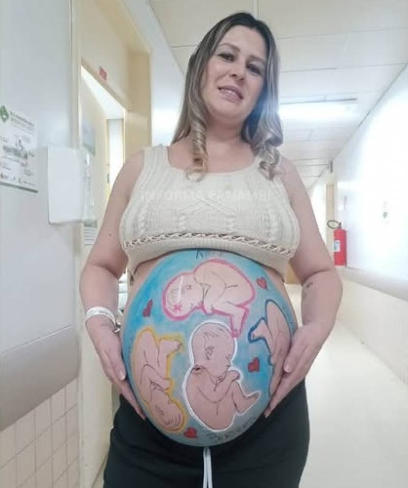 Moradora de Panambi será submetida a parto de emergência de quadrigêmeos nesta sexta-feira (26).
