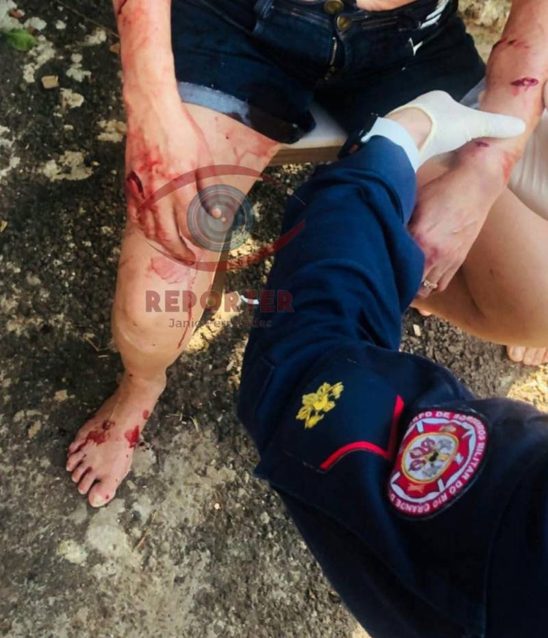 Mulher fica ferida após ser atacada por pitbull no bairro Oswaldo Aranha, em Ijuí